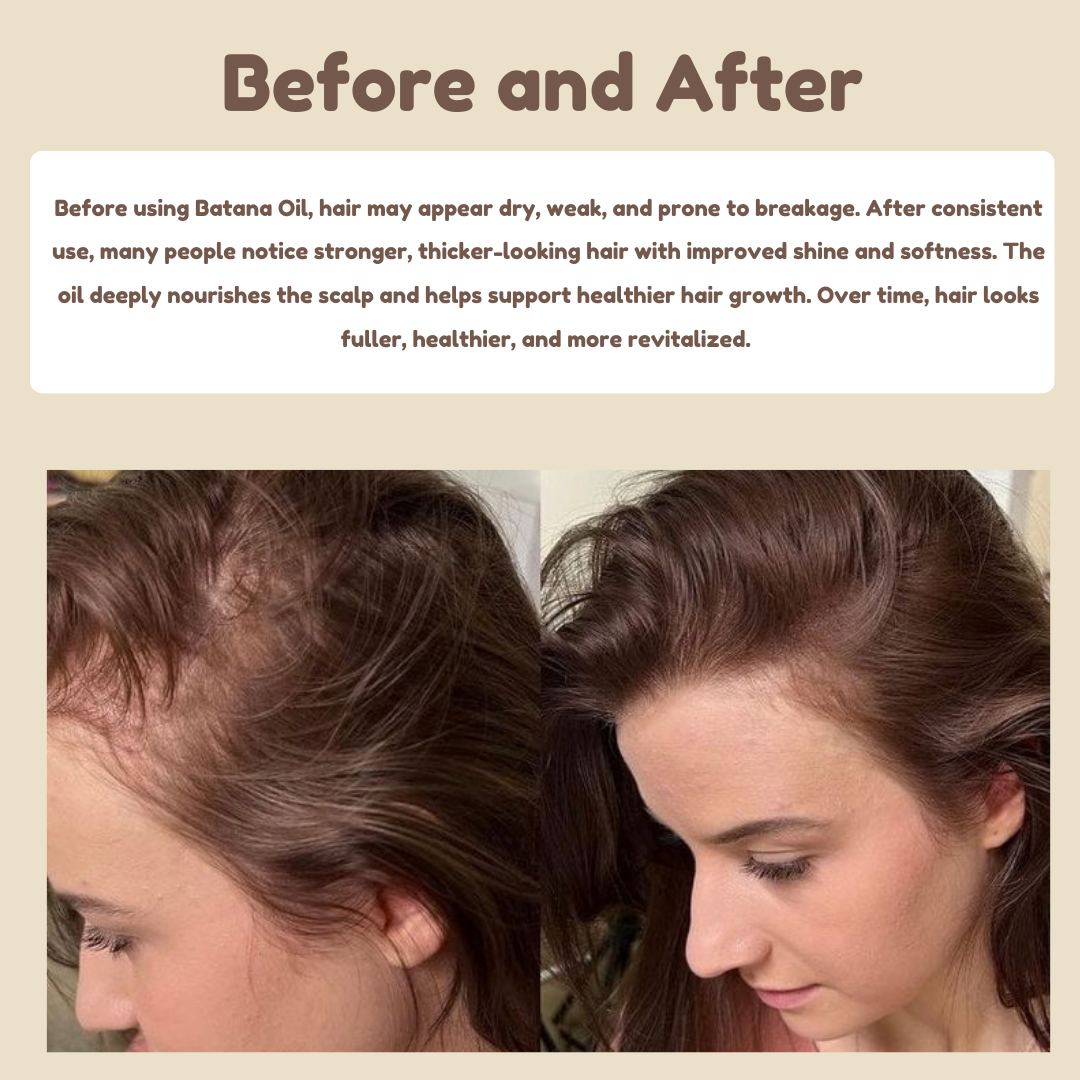 Batana Oil Complete Hair Care Set – Shampoo, Conditioner, Mask & Oils + Free Gifts